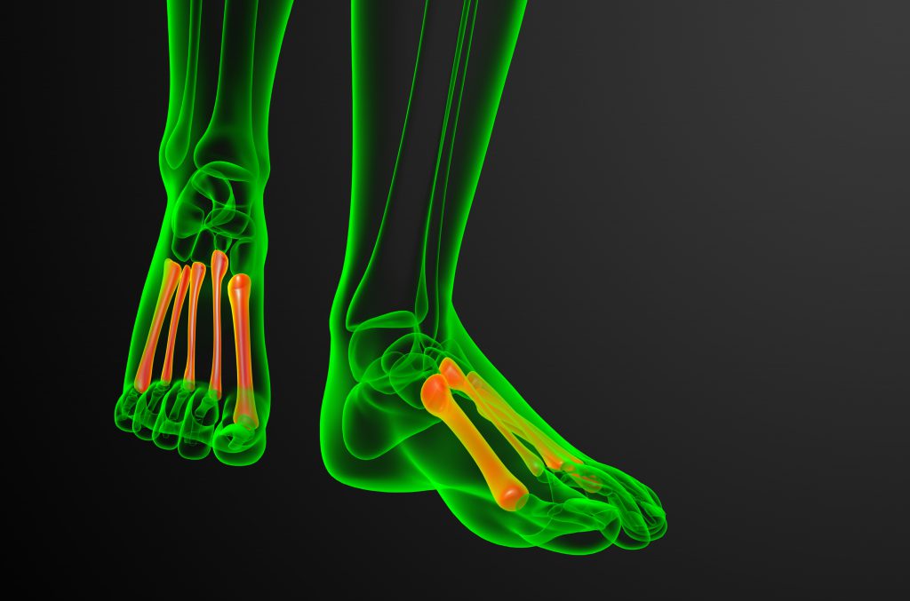 Starting From the Top: 4 Things to Know About Workplace Foot Injuries